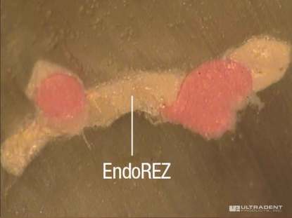 5_EndoREZ-USA-Sequece-Test-2_Clinical