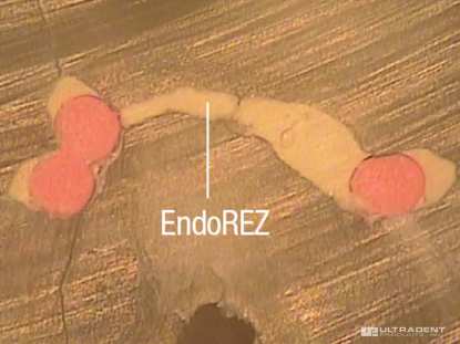 7_EndoREZ-USA-Sequece-Test-4_Clinical