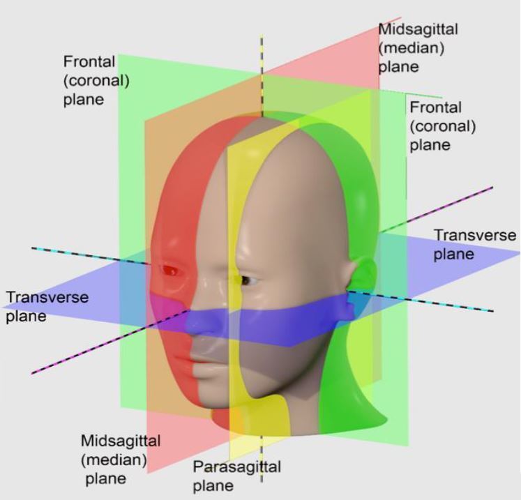 3° Dimentions คอร์สเรียนจัดฟัน