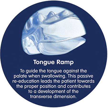 Tongue Ramp
