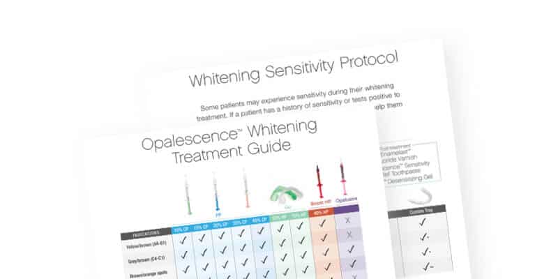 Opalescence Whitening Treatment Guide